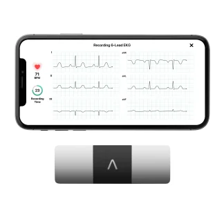 AliveCor KardiaMobile 6L Personal EKG Monitor, Black - KM-6L-E